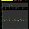 SSF BAT3-Detector - Flaggermus detektor med spektogram og sonogram.